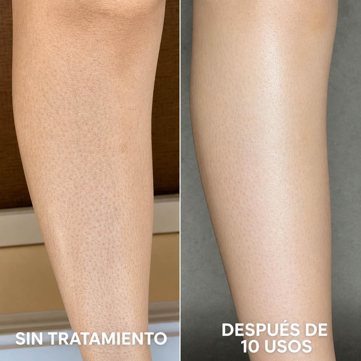 Crema Renovadora Corporal | Para piel de gallina y puntos rojos | Strawberry™